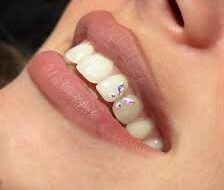 стать зубным техником по стразам