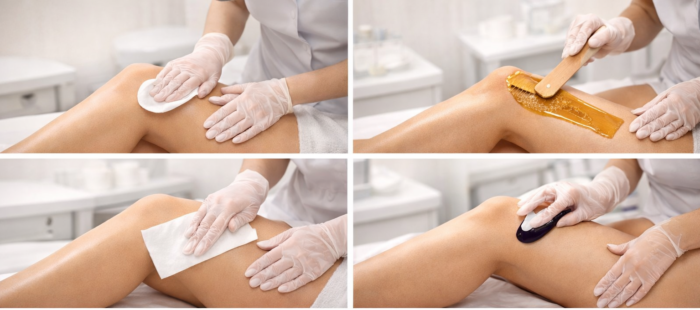 protocole épilation